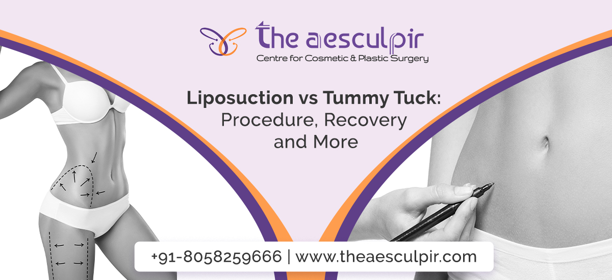 liposuction vs tummy tuck