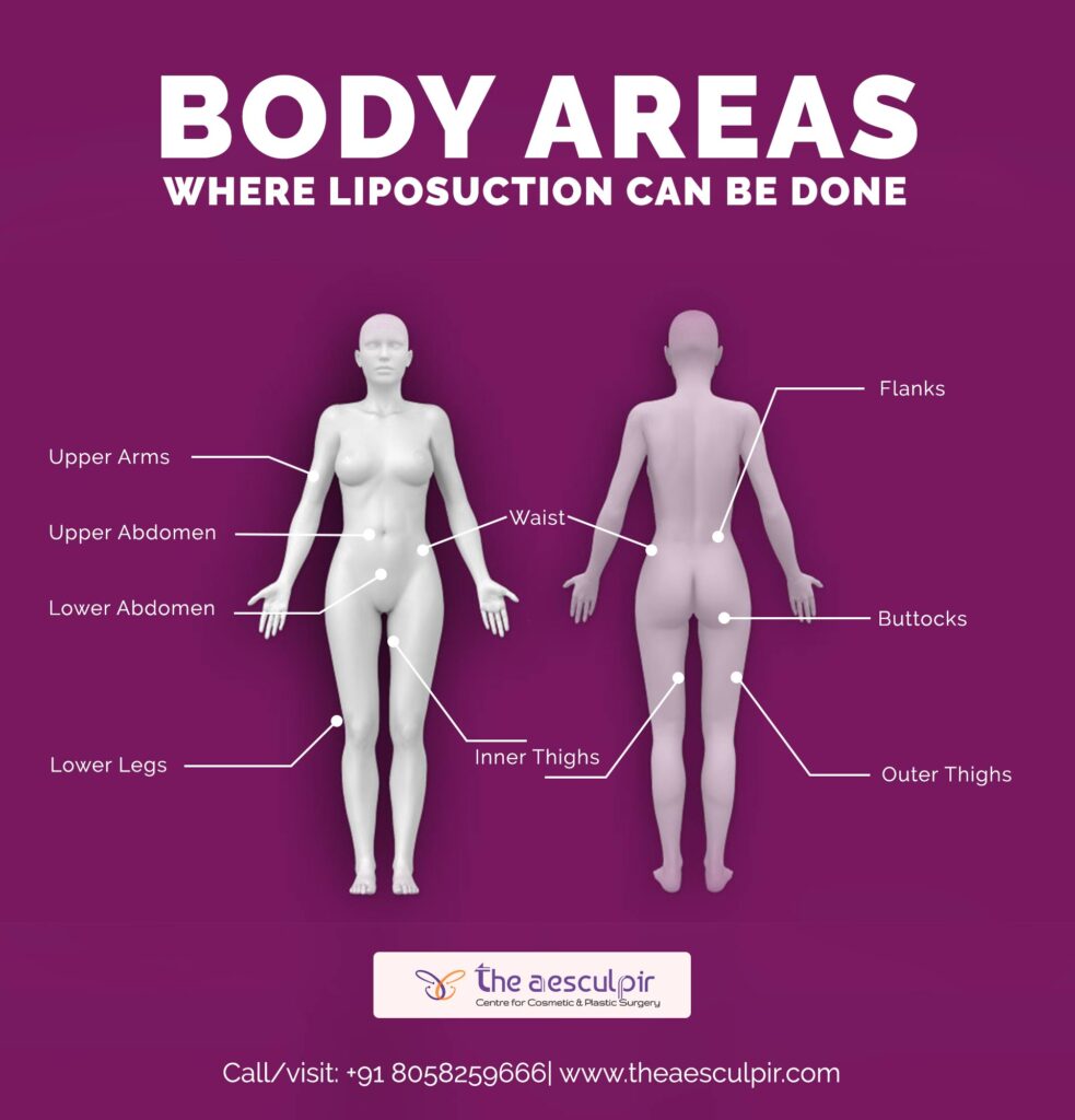 Body Areas where liposuction can be done