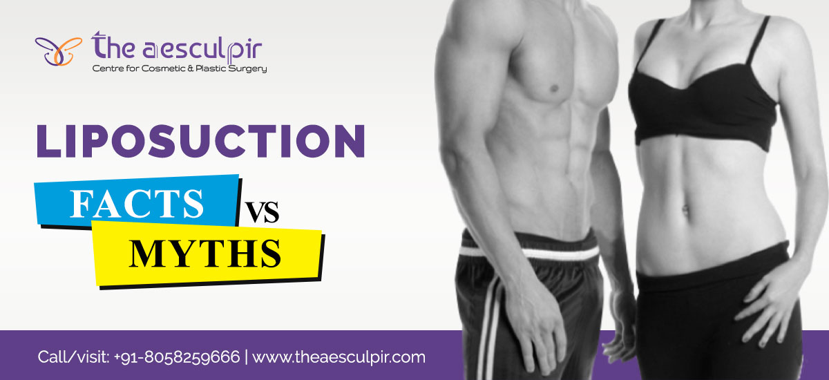 Liposuction Surgery: Facts vs Myths / Aesculpir Clinic