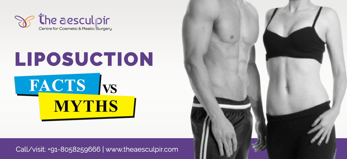 LIposuction Facts vs Myths