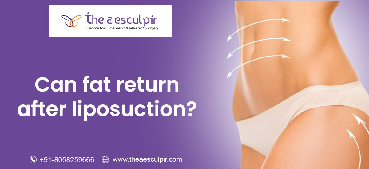 Liposuction Recovery / Aesculpir Clinic