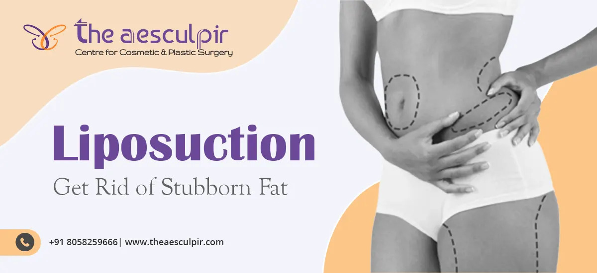 Best Liposuction / Fat Removal Surgery in Delhi