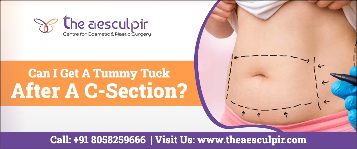 how to tuck tummy after c section