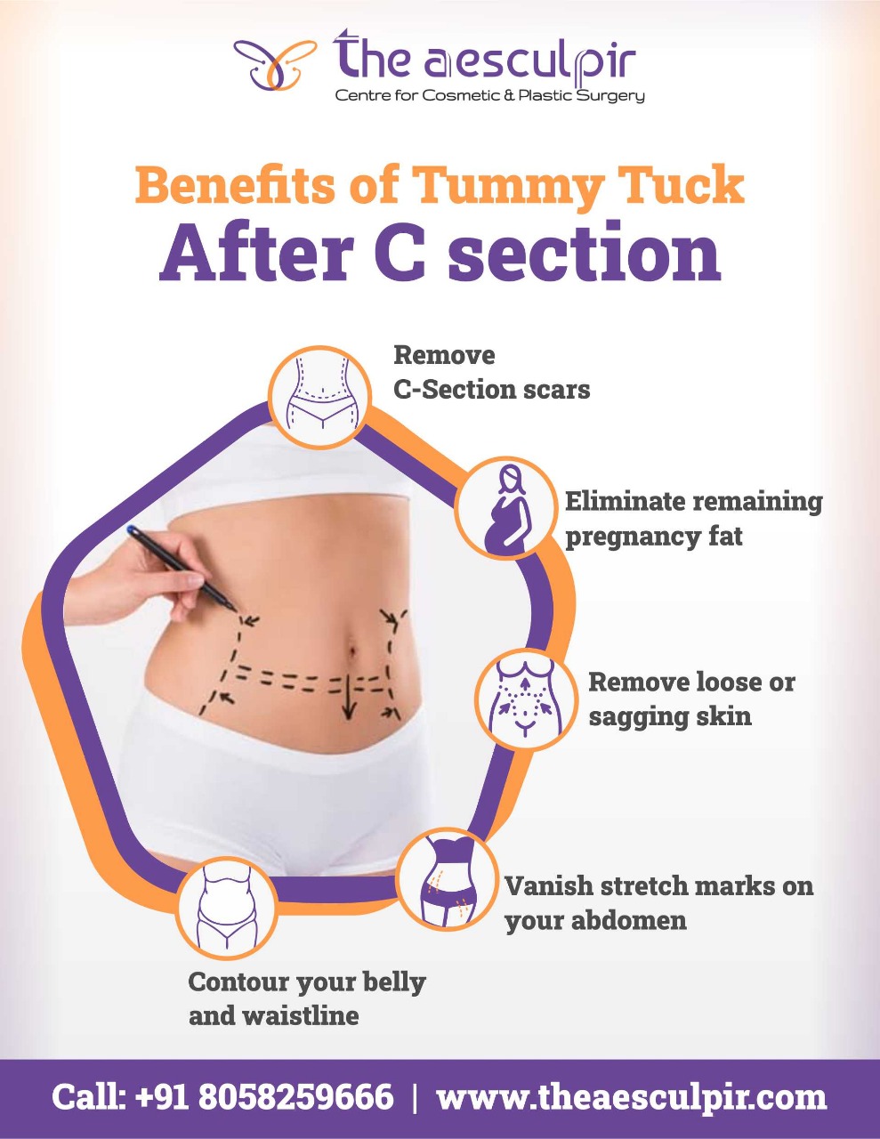 tummy tuck after c section