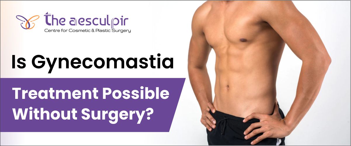 gynecomastia-