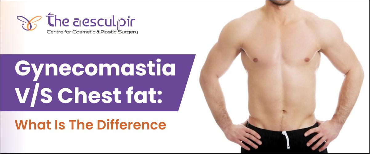 Gynaecomastia Vs Chest Fat