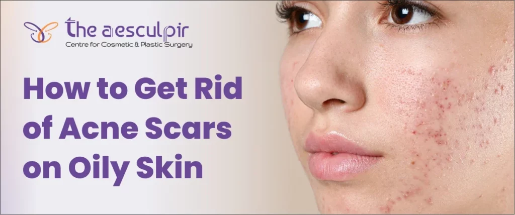 Acne Scars