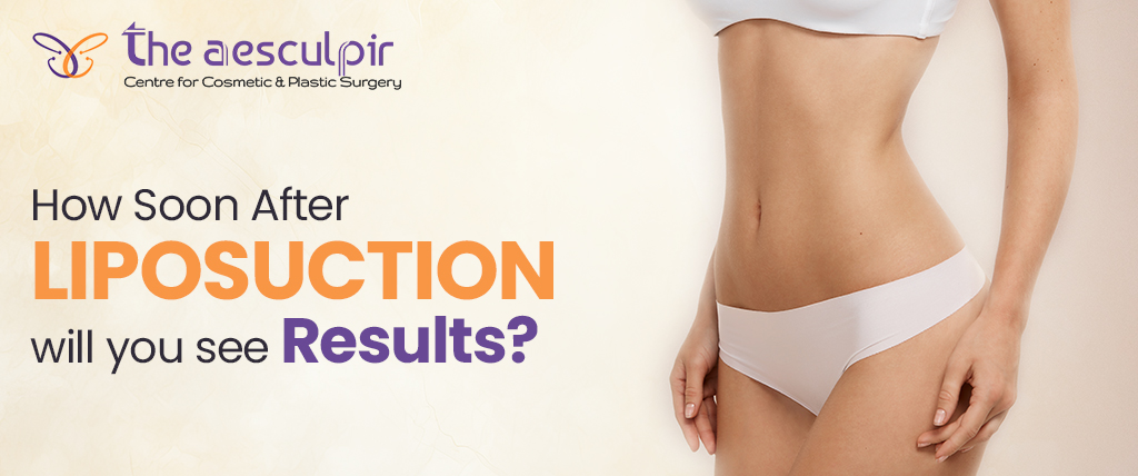 How Soon After Liposuction Will You See Results?