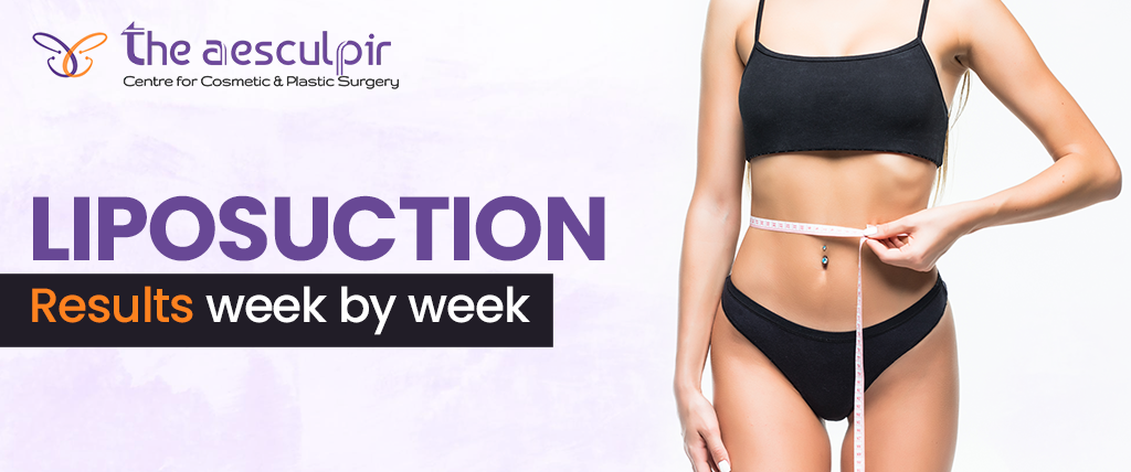 Liposuction Results Week by Week