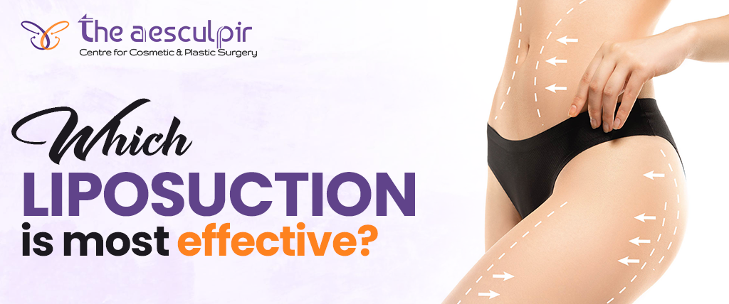 Which Liposuction Is Most Effective?